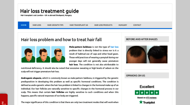 abouthairloss.co.uk