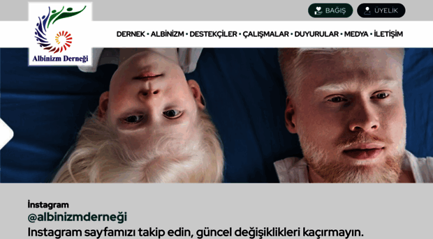 albinizm.org.tr