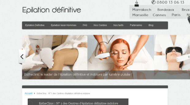 allo-epilation-laser.com