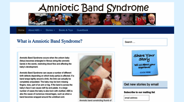 amnioticbandsyndrome.com