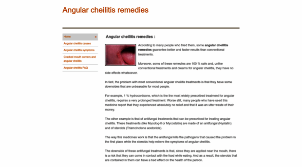angular-cheilitis-remedies.weebly.com