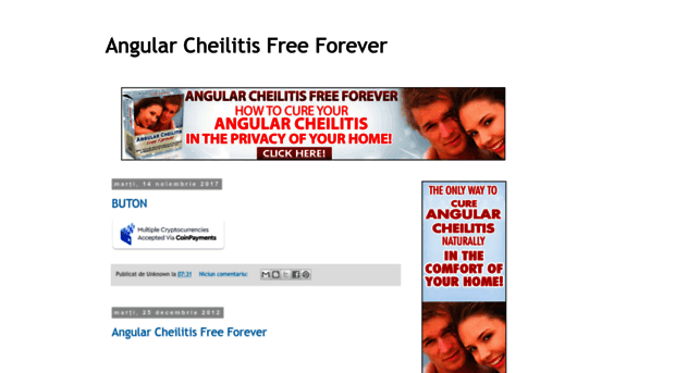 angularcheilitis-free-forever.blogspot.ro