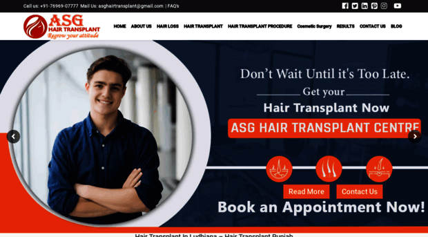 asghairtransplant.com