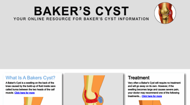 bakers-cyst.com