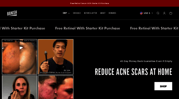 banishacnescars.com