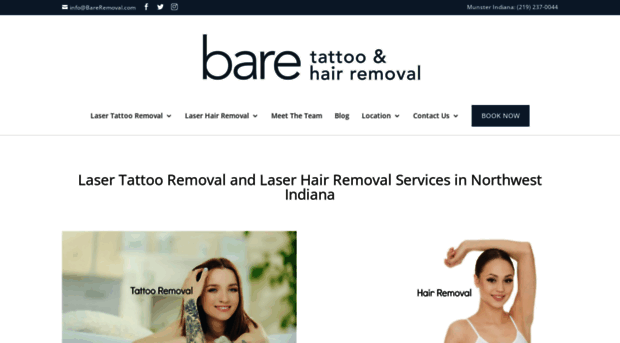 bareremoval.com