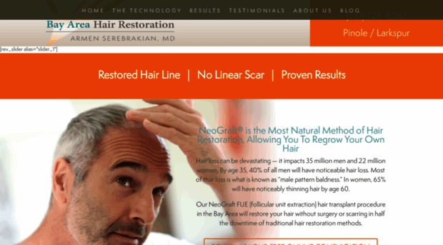 bayareahairloss.com