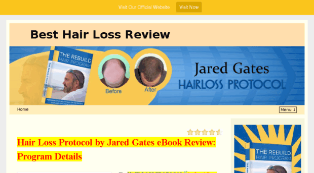 besthairlossreview.com