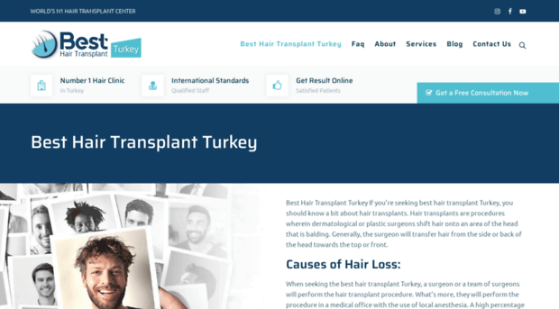 besthairtransplantturkey.com