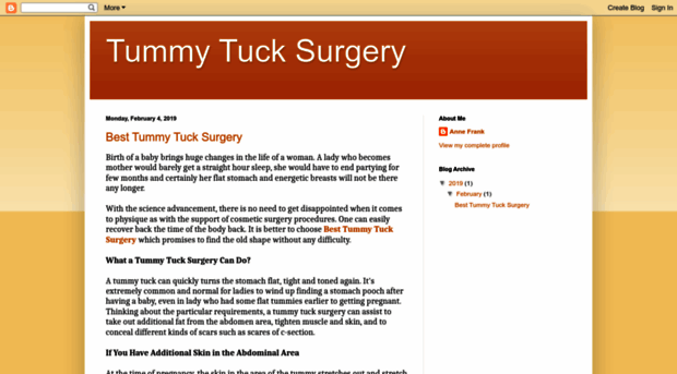 besttummytucksurgery.blogspot.com