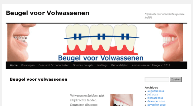 beugelvoorvolwassenen.nl