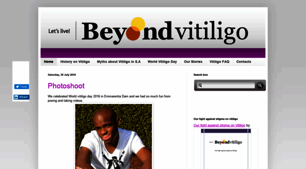 beyondvitiligosa.blogspot.com