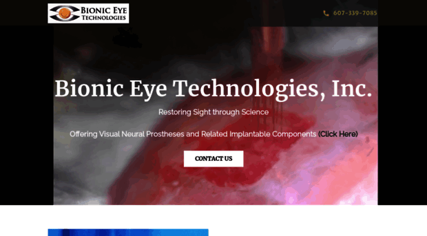 bionicvisiontechnologies.com