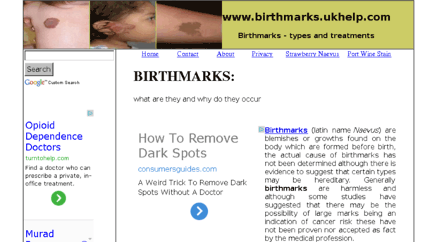 birthmarks.ukhelp.com