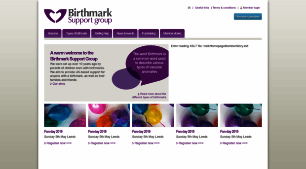 birthmarksupportgroup.org.uk