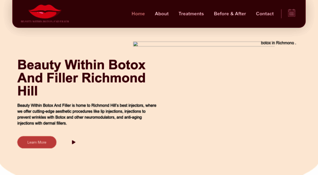 botoxandfiller.ca