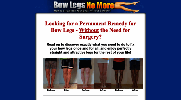 bowlegsnomore.com