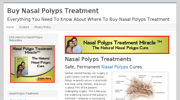 buynasalpolypstreatment.com