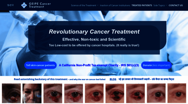 cancer-treatment.net