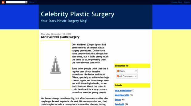 celebrityplasticsurgery.blogspot.com