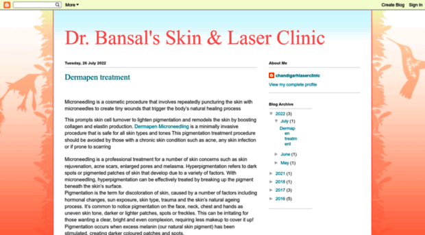 chandigarhlaserclinic.blogspot.com