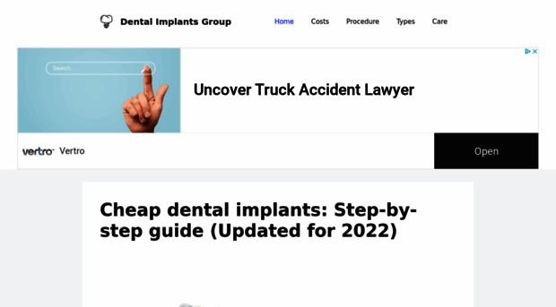 cheapdentalimplants.org