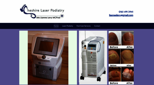 cheshire-laser-podiatry.co.uk