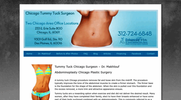 chicagotummytuck.net