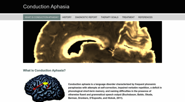 conductionaphasia.weebly.com