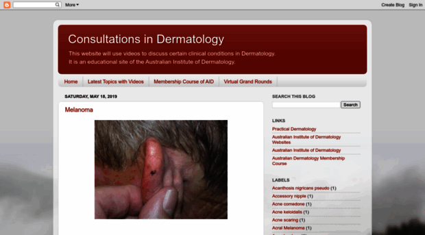 consultationsindermatology.blogspot.com.es