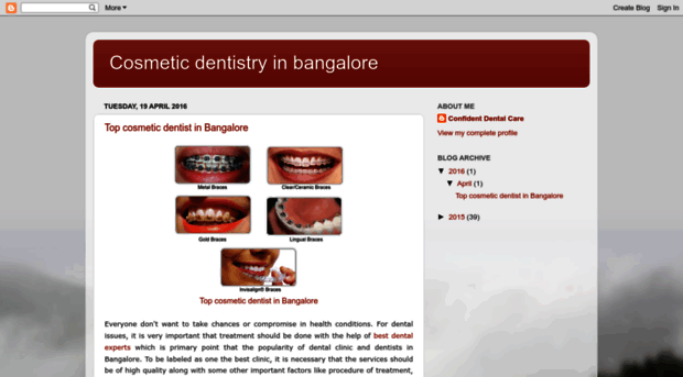 cosmeticdentistrybangalore.blogspot.in