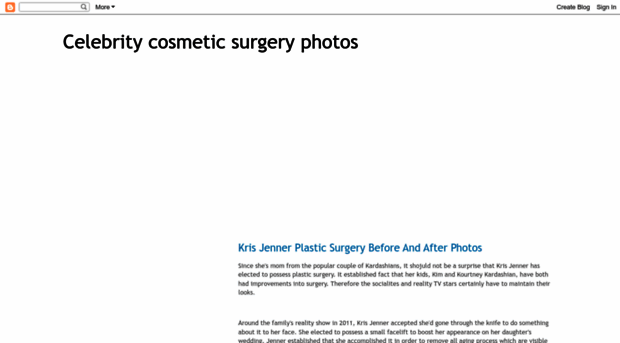 cosmeticsurgeryphoto.blogspot.com