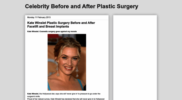 cplasticsurgery.blogspot.com