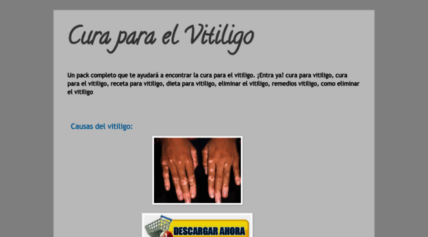 curaparaelvitiligo.blogspot.com