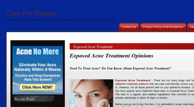 cureforpimples.us