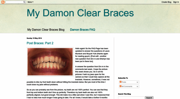 damonclearbraces.blogspot.com