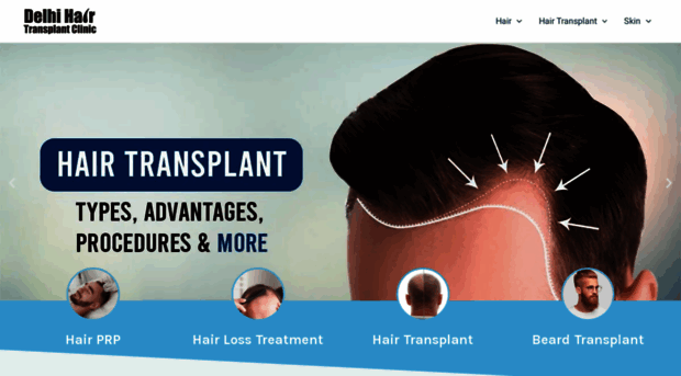 delhihairtransplantclinic.com