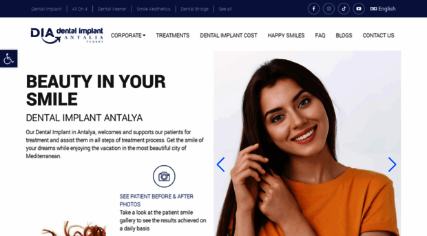 dentalimplantantalia.com