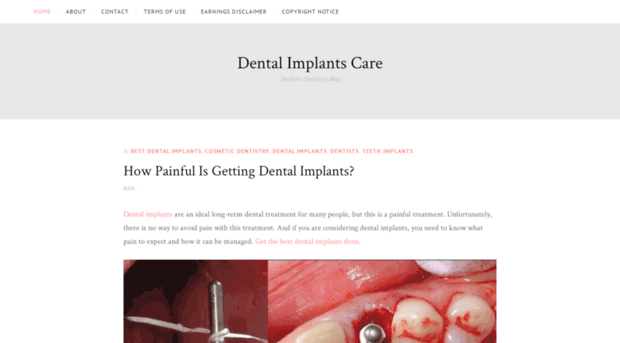 dentalimplantscare.com