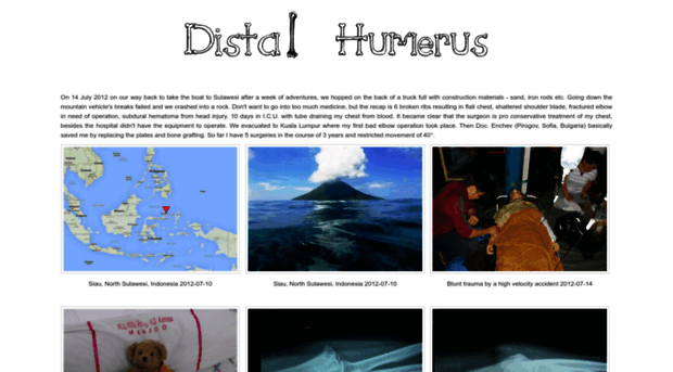 distal-humerus.com