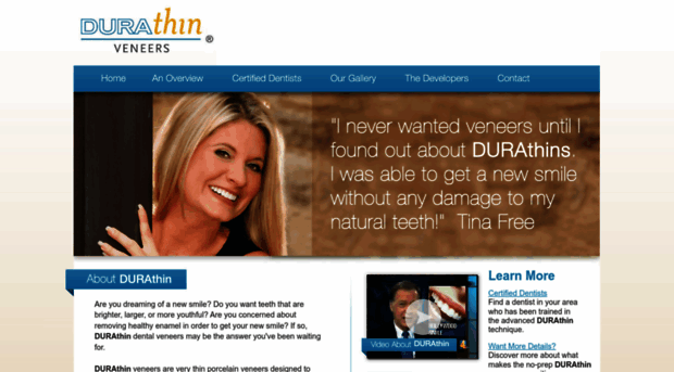 durathinveneers.com