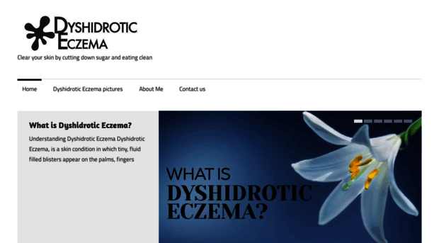 dyshidrotic.com