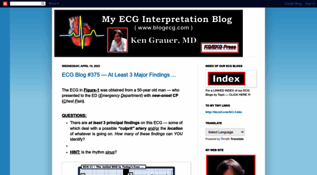 ecg-interpretation.blogspot.am