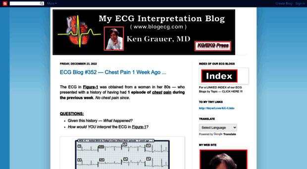 ecg-interpretation.blogspot.kr