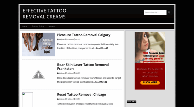 effectivetattooremovalcreams.blogspot.com