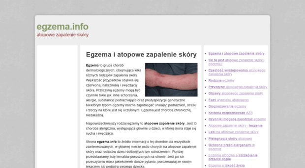 egzema.info