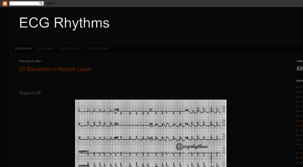 ekgrhythm.com