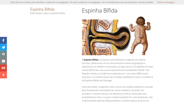 espinhabifida.com