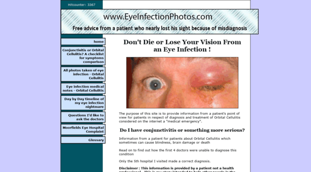 eyeinfectionphotos.com