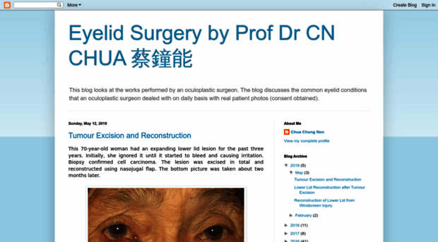 eyelidsurgerymalaysia.blogspot.com